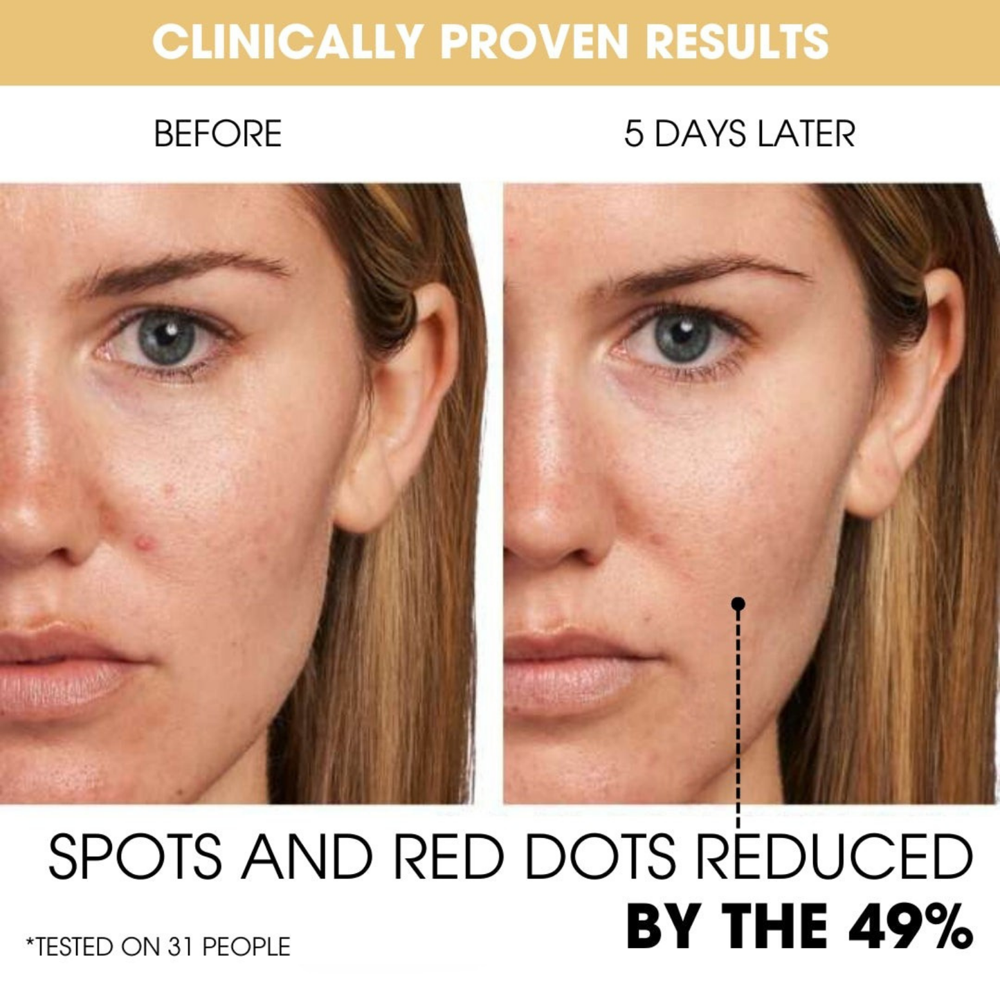 Vitamin C Capsules With Gel