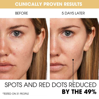 Vitamin C Capsules With Gel