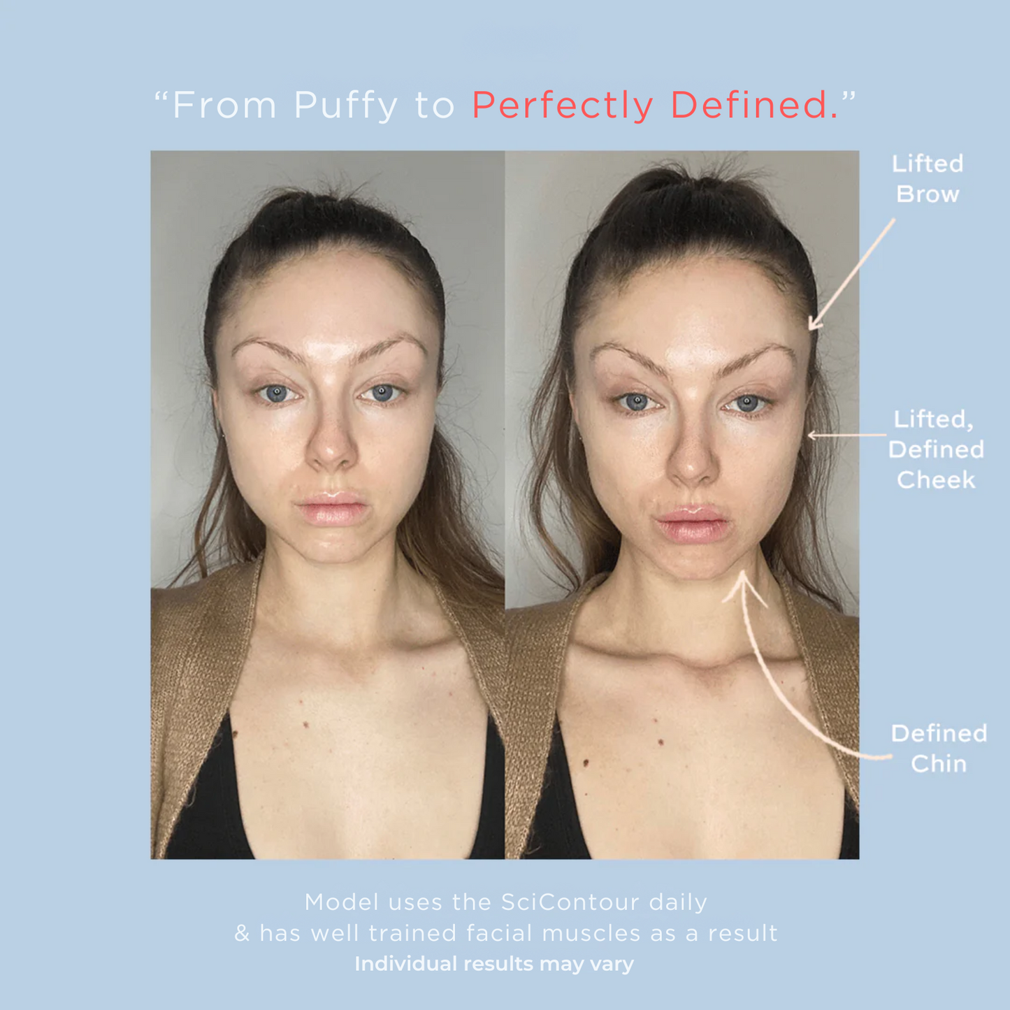 SciContour Face Cupping Device