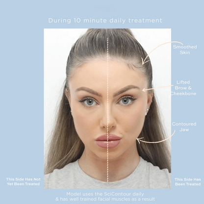 SciContour Face Cupping Device